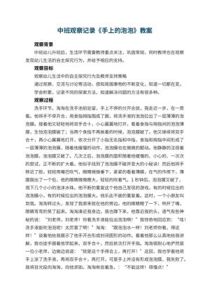 幼儿园中班观察记录《手上的泡泡》 包含反思预览